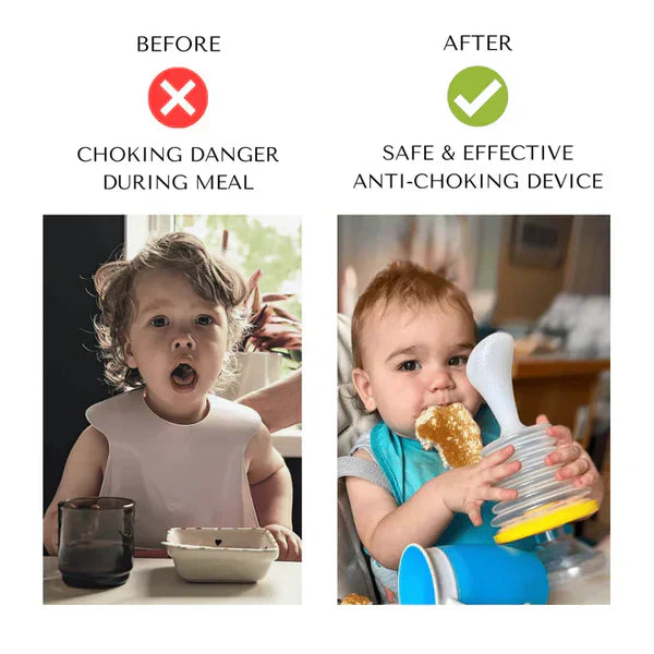 HOOMIGO™ ANTI-CHOKING DEVICE